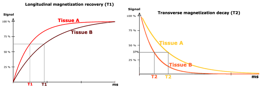 Рисунок 9. Измерение времен Т1 и Т2 для разных тканей [4]
