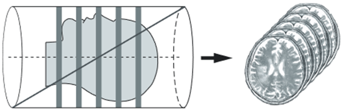 Рисунок 25. Слайсы, расположенные с зазорами [2]