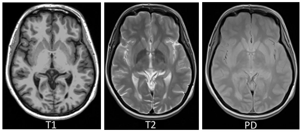 Рисунок. Примеры слайсов анатомических серий [источник]