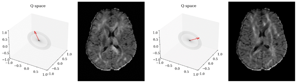 Рисунок 34. Примеры DWI-изображений для разных направлений градиентных импульсов  для одного и того же b-фактора [источник]
