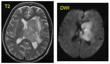 Рисунок. Примеры слайсов анатомической (слева) и функциональной (справа) серий [источник]