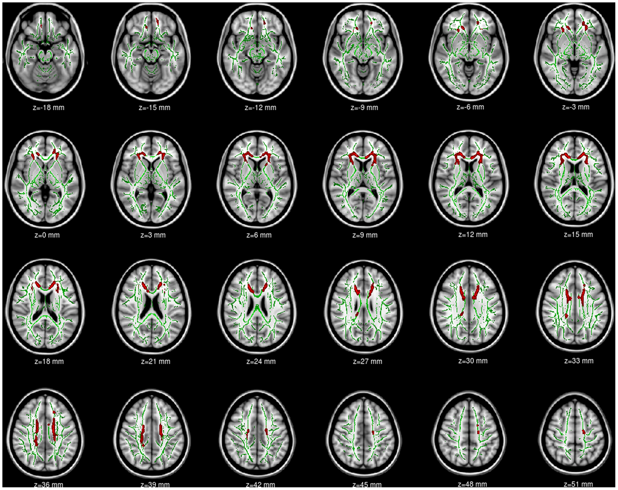 Соцсети как цифровой фастфуд - 3