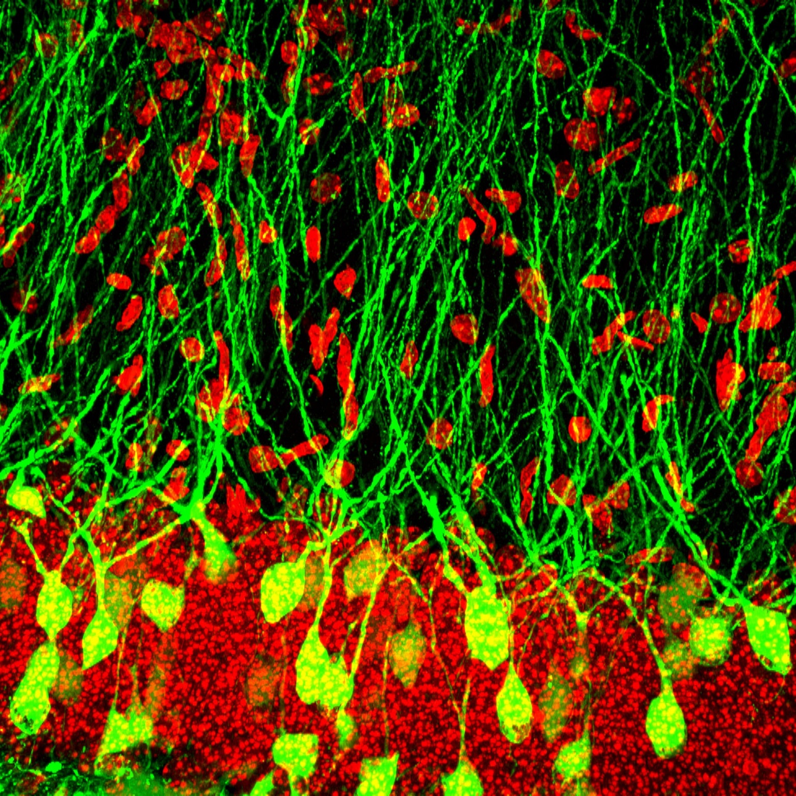  Разреженные гранулярные клетки, экспрессирующие ЗФБ.