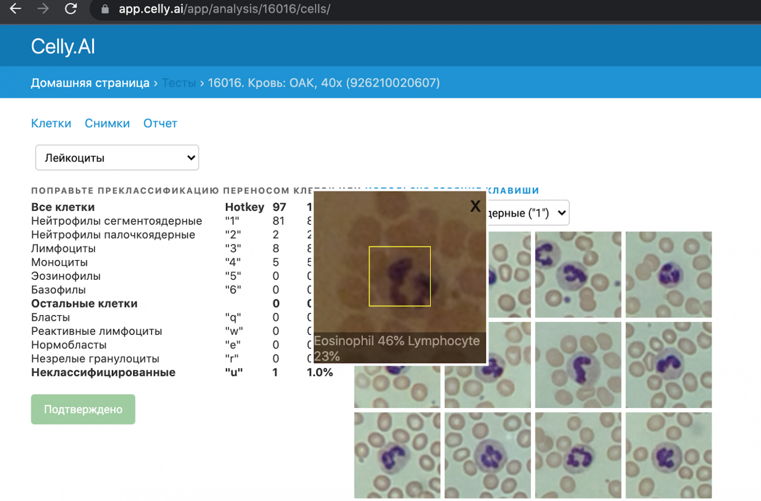Изображение с портала с кадром клетки без калибровки