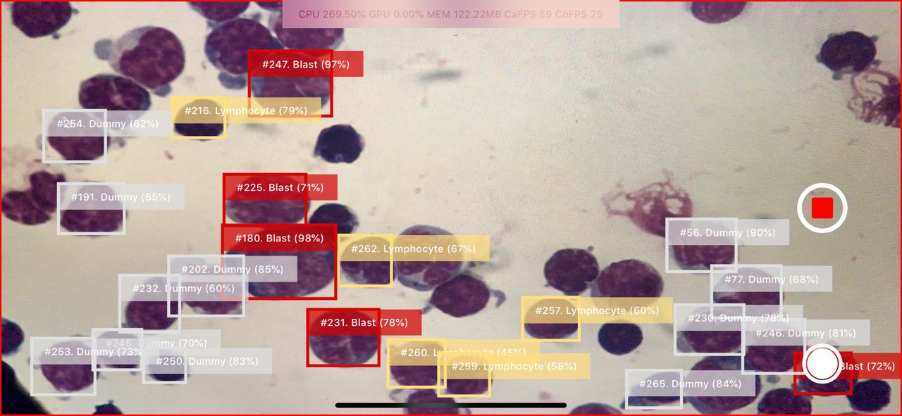 Bbox-ы задетектированных клеток