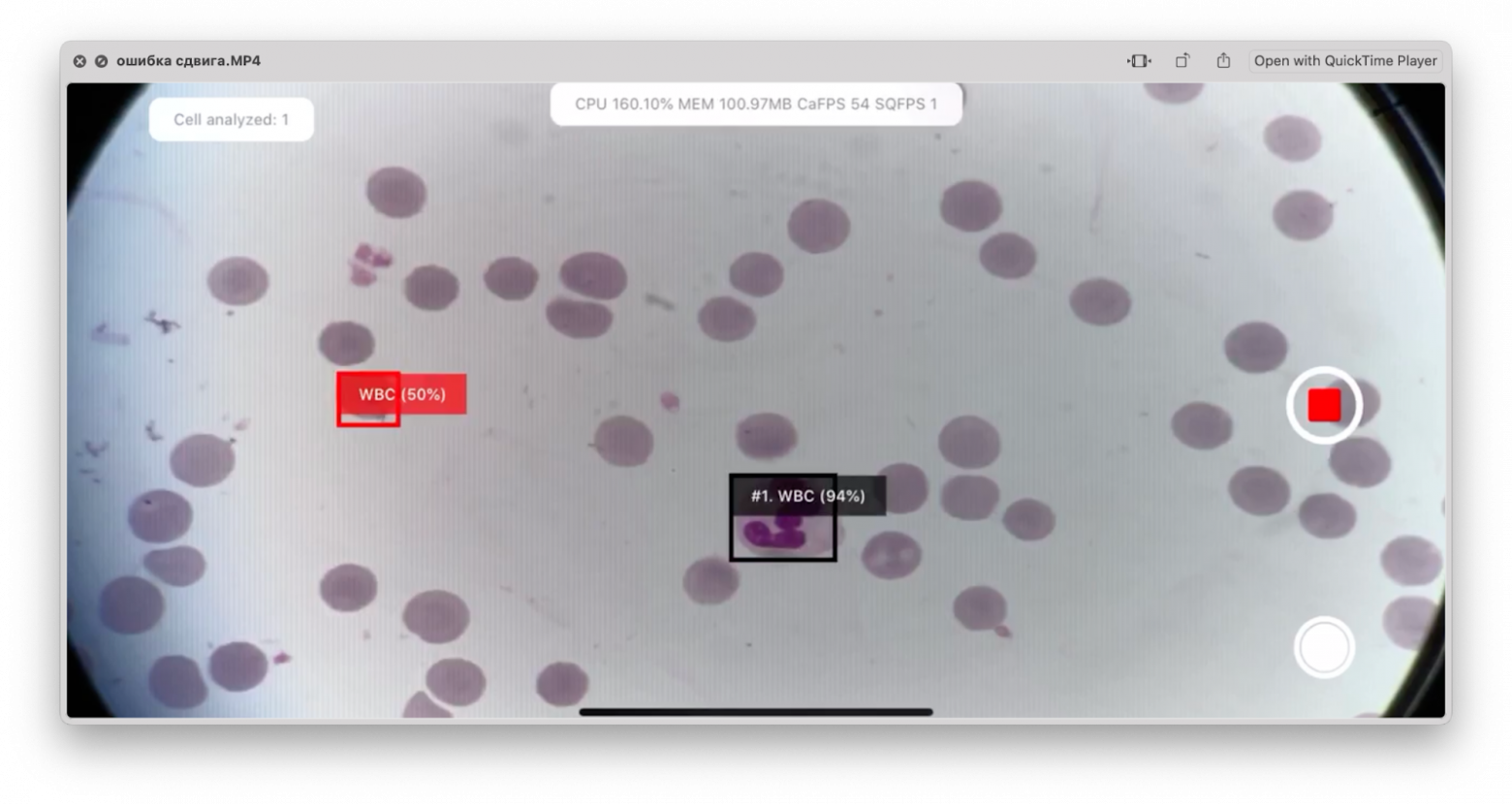 Красным отмечен отброшенный через флиьтры эритроцит