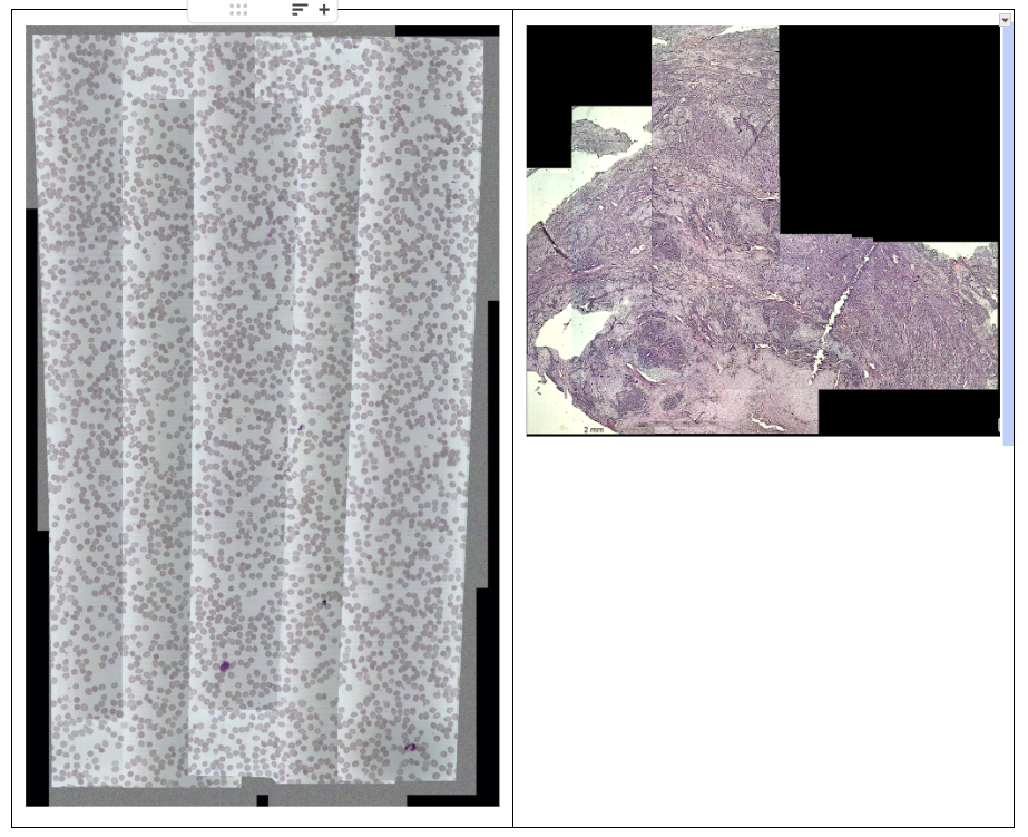 Слева — карта с неравномерной яркостью и экспозицией, на стыках кадров видны “швы. Справа — неровно сшитые изображения ткани с пропусками