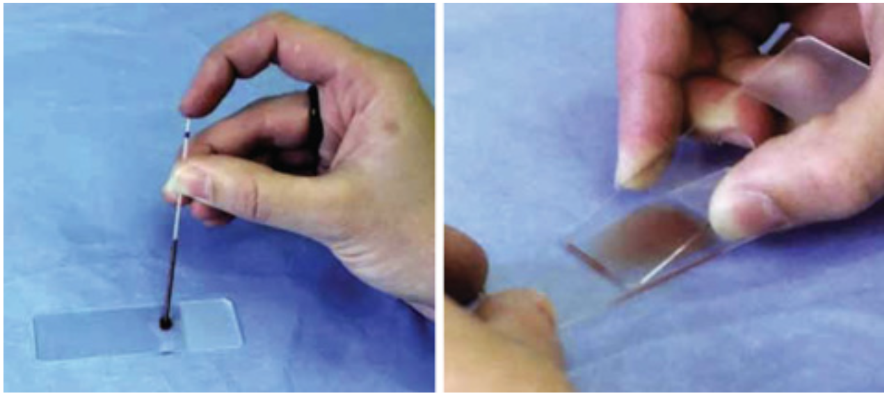 Приготовление мазка крови