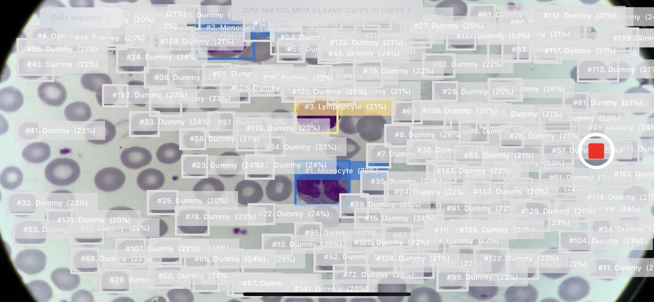 Большое кол-во детекций клеток на кадр