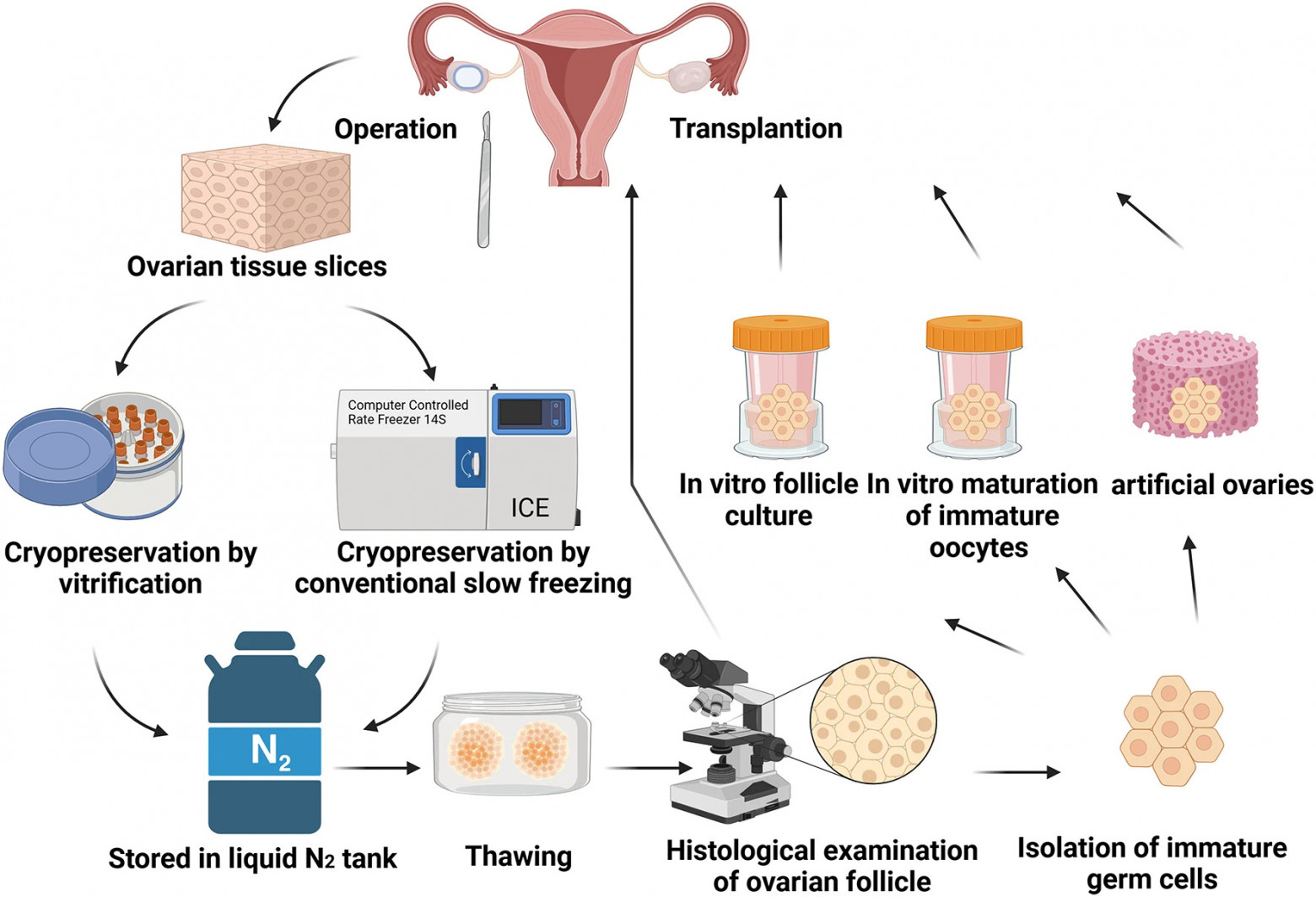 Схема заморозки ткани яичника из публикации: Kong Q. et al. Journal of Ovarian Research, 2025. https://doi.org/10.1186/s13048-024-01561-7