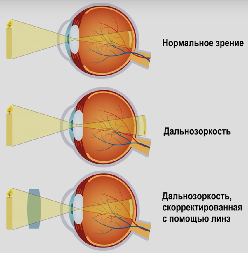 Разные типы зрения