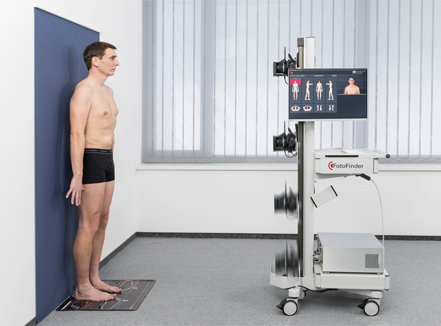 Диагностика родинок всего тела на аппарате FotoFinder