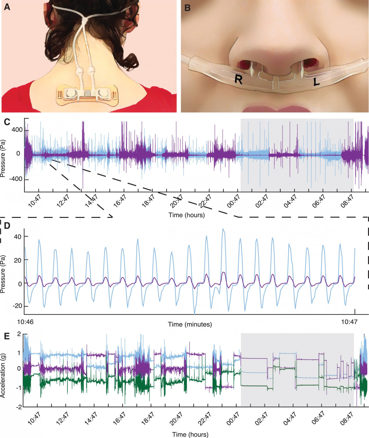 Вдох, выдох: идентификация и диагностика по дыханию - 2
