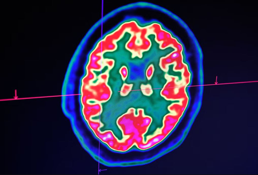 Китайские учёные: ИИ способен формировать представления об объектах, сходные с человеческими - 1 Китайские учёные: ИИ способен формировать представления об объектах, сходные с человеческими - 1