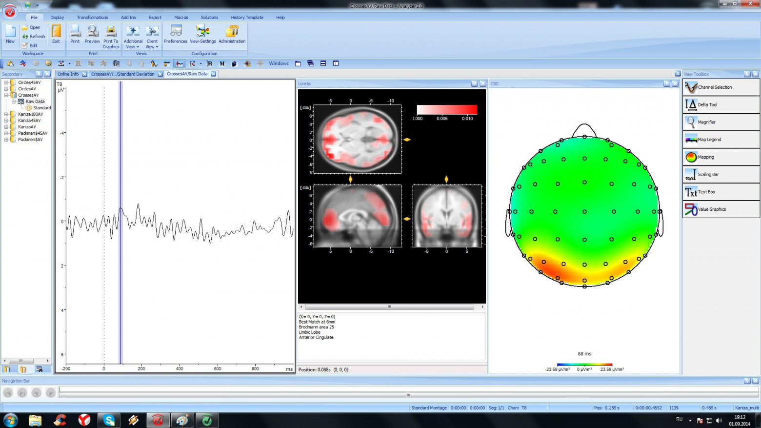 В лаборатории психофизиологии МГУ: ЭЭГ как инструмент реверс-инжиниринга мозга и интерфейс мозг-компьютер - 14 В лаборатории психофизиологии МГУ: ЭЭГ как инструмент реверс-инжиниринга мозга и интерфейс мозг-компьютер - 14