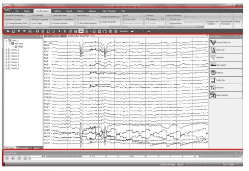 В лаборатории психофизиологии МГУ: ЭЭГ как инструмент реверс-инжиниринга мозга и интерфейс мозг-компьютер - 15 В лаборатории психофизиологии МГУ: ЭЭГ как инструмент реверс-инжиниринга мозга и интерфейс мозг-компьютер - 15