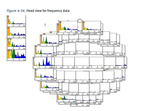 В лаборатории психофизиологии МГУ: ЭЭГ как инструмент реверс-инжиниринга мозга и интерфейс мозг-компьютер - 20 В лаборатории психофизиологии МГУ: ЭЭГ как инструмент реверс-инжиниринга мозга и интерфейс мозг-компьютер - 20