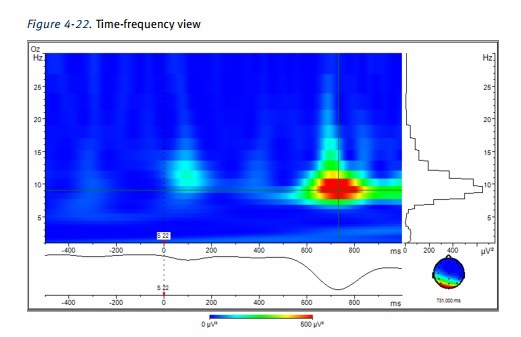 В лаборатории психофизиологии МГУ: ЭЭГ как инструмент реверс-инжиниринга мозга и интерфейс мозг-компьютер - 21 В лаборатории психофизиологии МГУ: ЭЭГ как инструмент реверс-инжиниринга мозга и интерфейс мозг-компьютер - 21