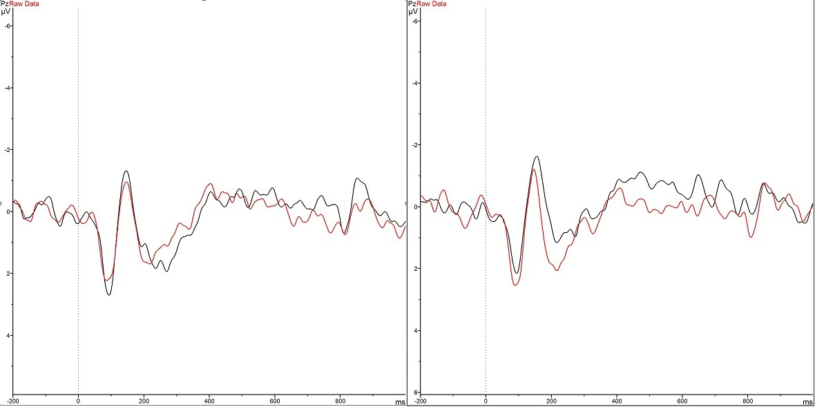 В лаборатории психофизиологии МГУ: ЭЭГ как инструмент реверс-инжиниринга мозга и интерфейс мозг-компьютер - 25 В лаборатории психофизиологии МГУ: ЭЭГ как инструмент реверс-инжиниринга мозга и интерфейс мозг-компьютер - 25