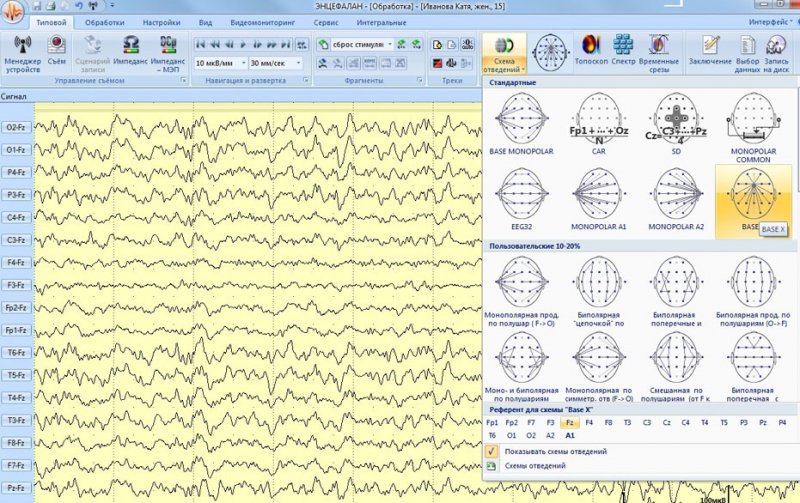 В лаборатории психофизиологии МГУ: ЭЭГ как инструмент реверс-инжиниринга мозга и интерфейс мозг-компьютер - 29 image