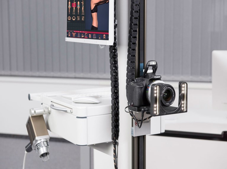 Аппарат FotoFinder