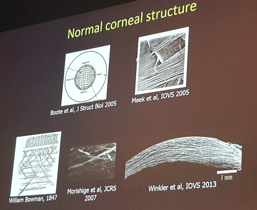 Нормальная структура роговицы глаза