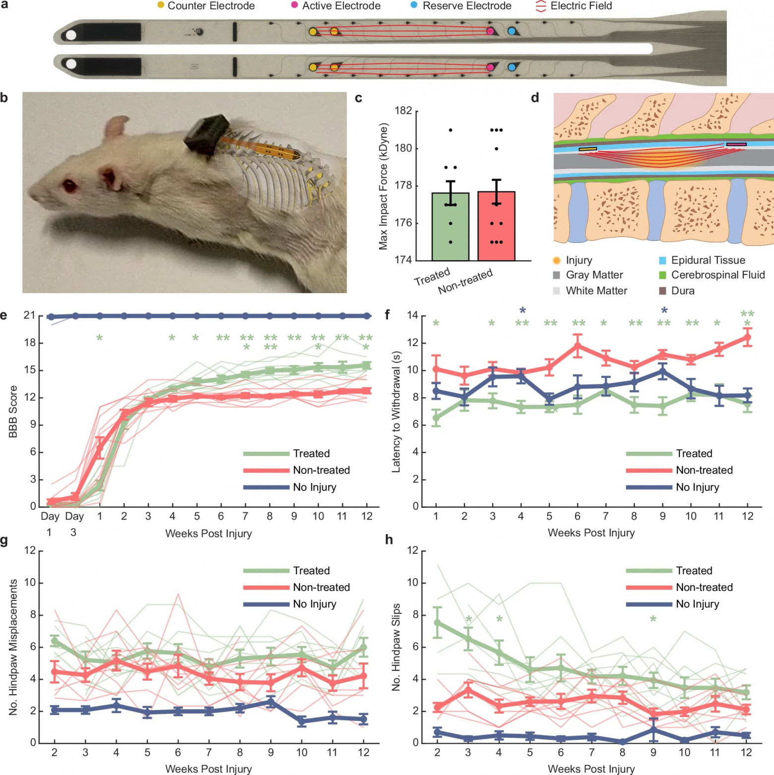 Стимуляция восстановления спинного мозга - 2