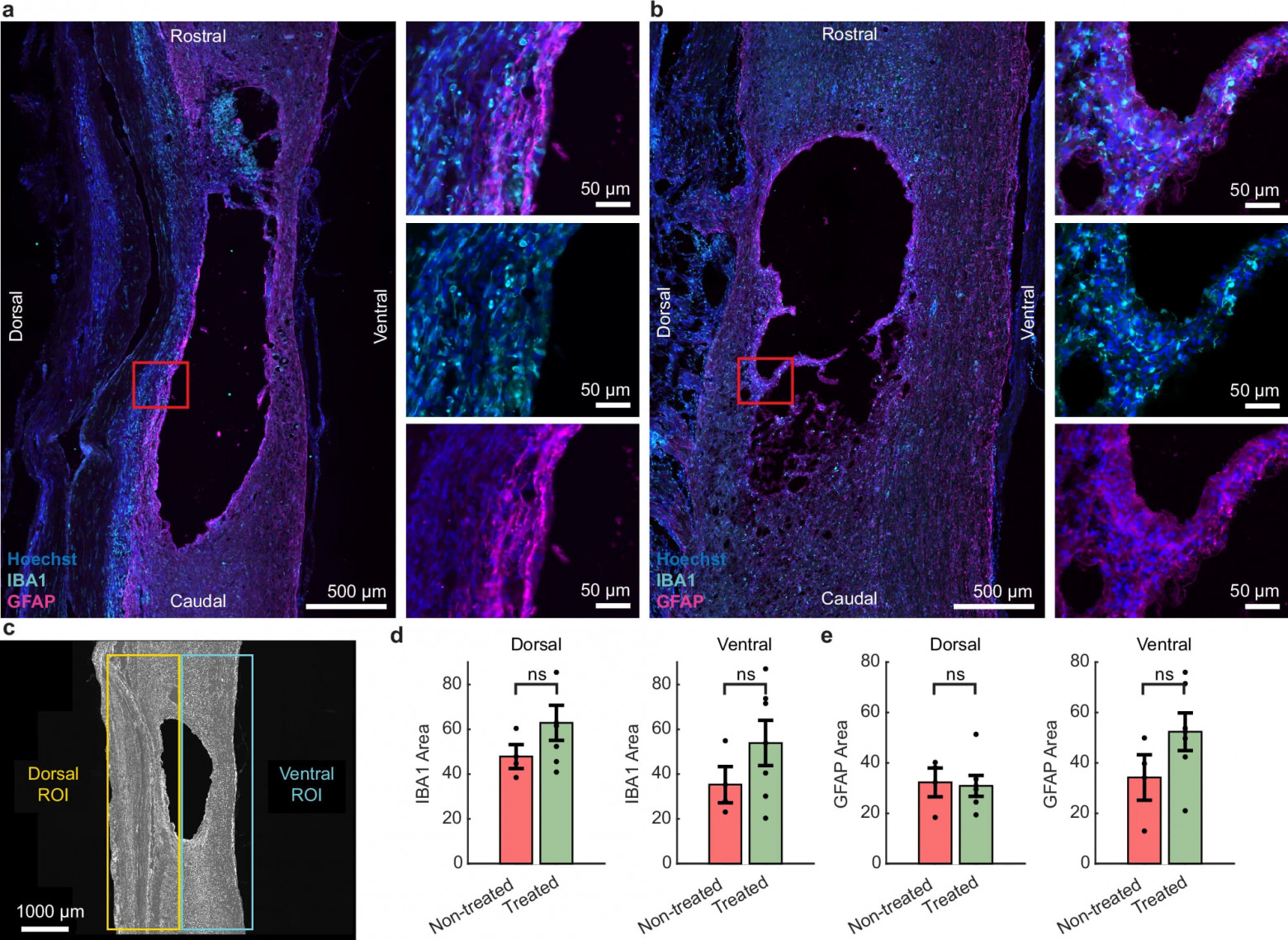 Стимуляция восстановления спинного мозга - 3
