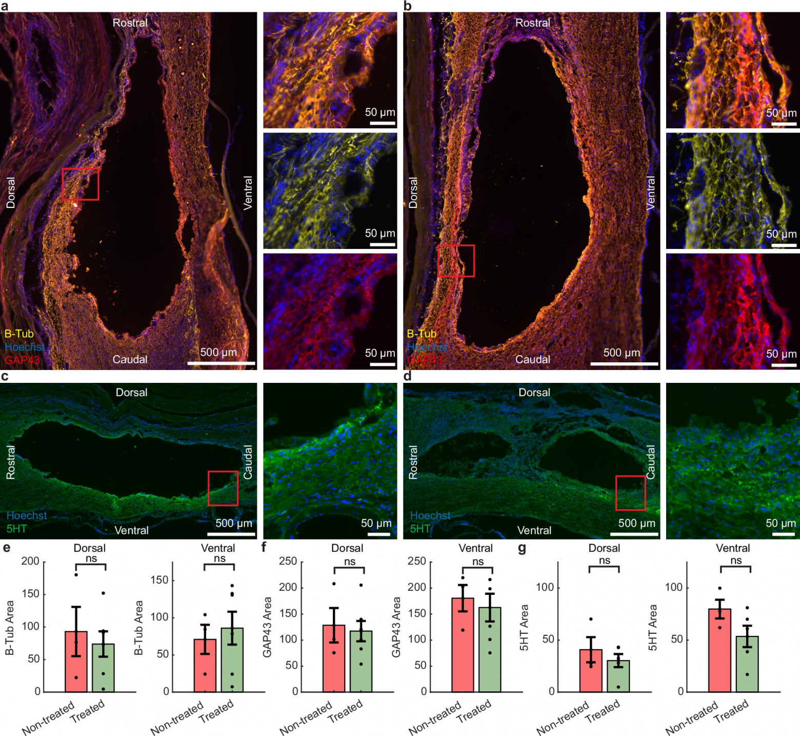 Стимуляция восстановления спинного мозга - 4