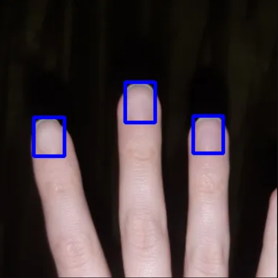 Детекция зон интереса (ногти) для дальнейшего анализа нейросетью   
