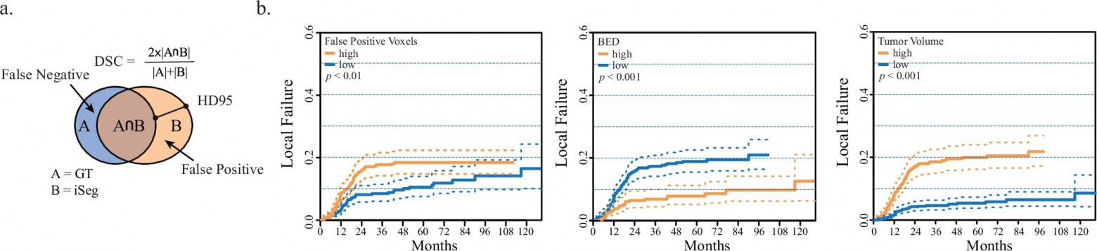 ИИ в радиологии: определение контура опухоли легких во время дыхания - 6 ИИ в радиологии: определение контура опухоли легких во время дыхания - 6