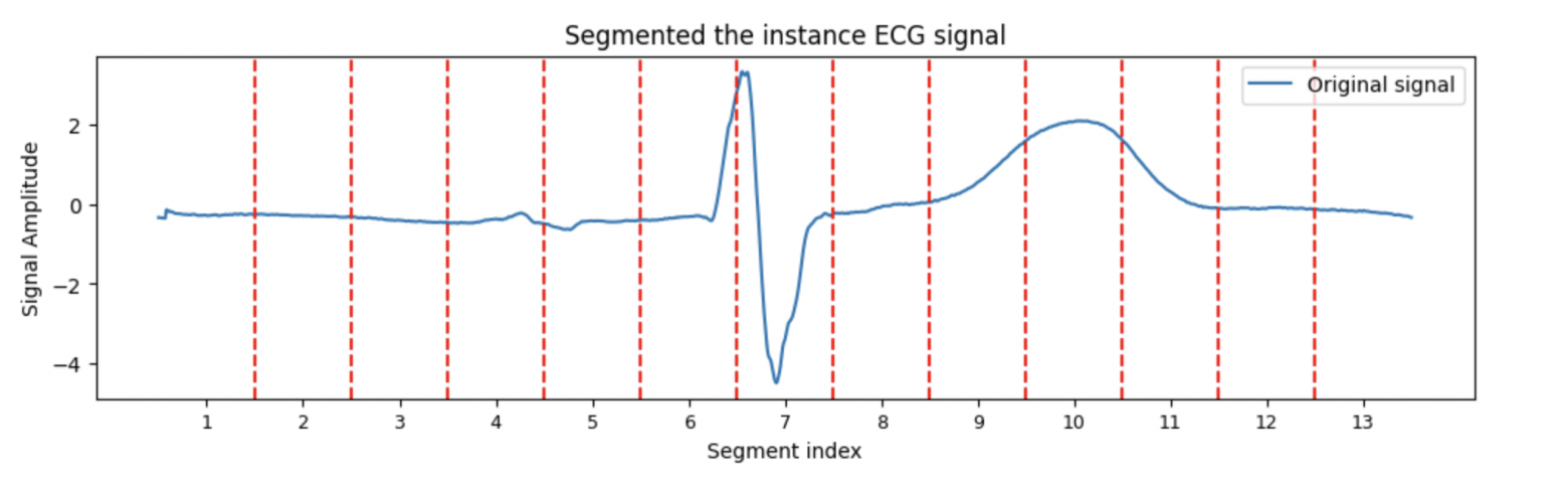 Сигнал ЭКГ, разбитый на сегменты