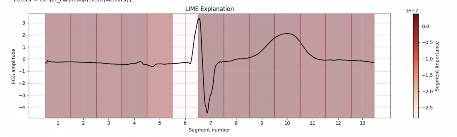 Веса LIME на графике по сегментам