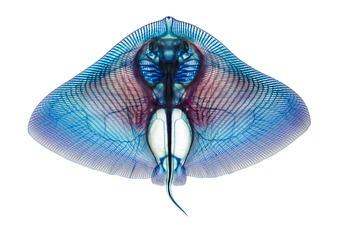 Диафанизация — зрелищный дотучинский метод просветления тканей постмортем