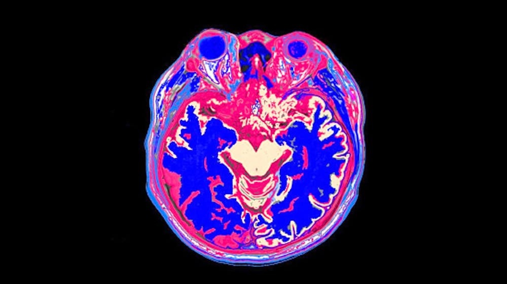  Мы с коллегами используем сканирование мозга, подобное этому МРТ, чтобы изучить, что делает мозг, когда человек читает.