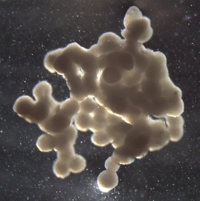 Щитовидка из сфероидов