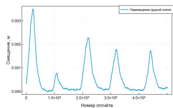 Бесконтактная ЭКГ: биорадиолокация и ИИ в действии - 15 Бесконтактная ЭКГ: биорадиолокация и ИИ в действии - 15