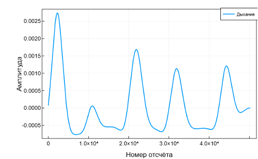 Бесконтактная ЭКГ: биорадиолокация и ИИ в действии - 16 Бесконтактная ЭКГ: биорадиолокация и ИИ в действии - 16