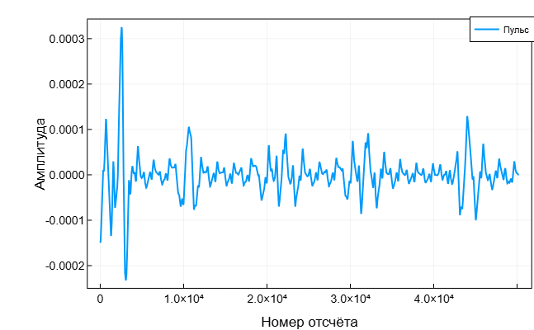 Бесконтактная ЭКГ: биорадиолокация и ИИ в действии - 17 Бесконтактная ЭКГ: биорадиолокация и ИИ в действии - 17