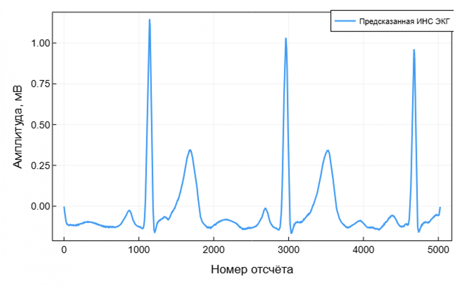 Бесконтактная ЭКГ: биорадиолокация и ИИ в действии - 24 Бесконтактная ЭКГ: биорадиолокация и ИИ в действии - 24