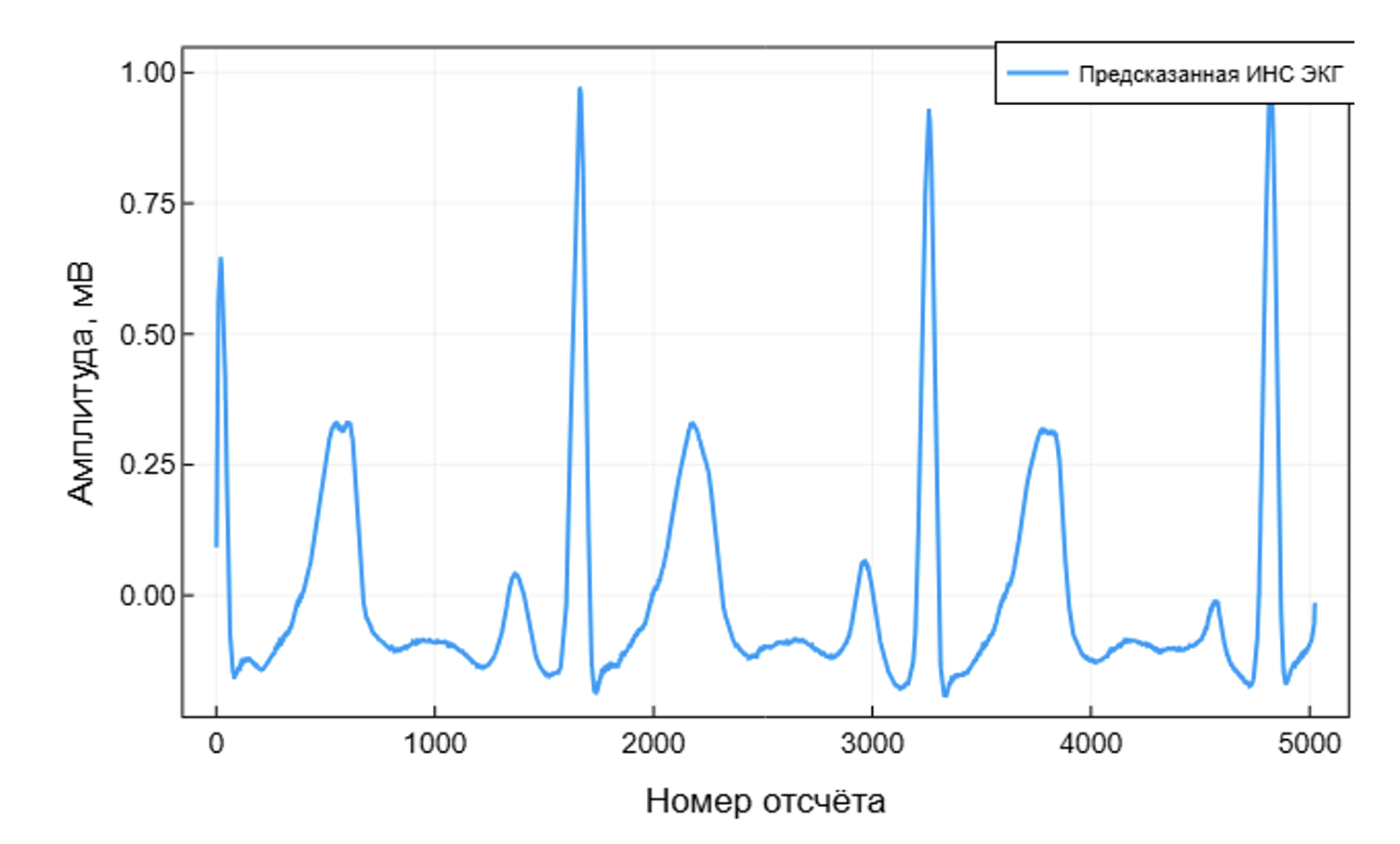 Бесконтактная ЭКГ: биорадиолокация и ИИ в действии - 25 Бесконтактная ЭКГ: биорадиолокация и ИИ в действии - 25