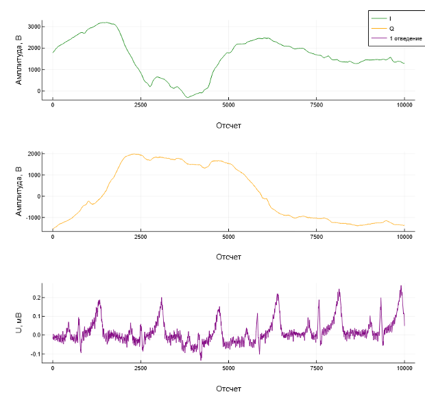 Бесконтактная ЭКГ: биорадиолокация и ИИ в действии - 1 Бесконтактная ЭКГ: биорадиолокация и ИИ в действии - 1