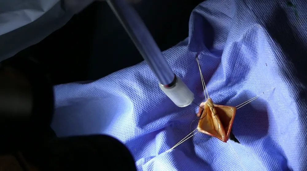 Роботы начинают принимать решения в операционной - 2 Роботы начинают принимать решения в операционной - 2