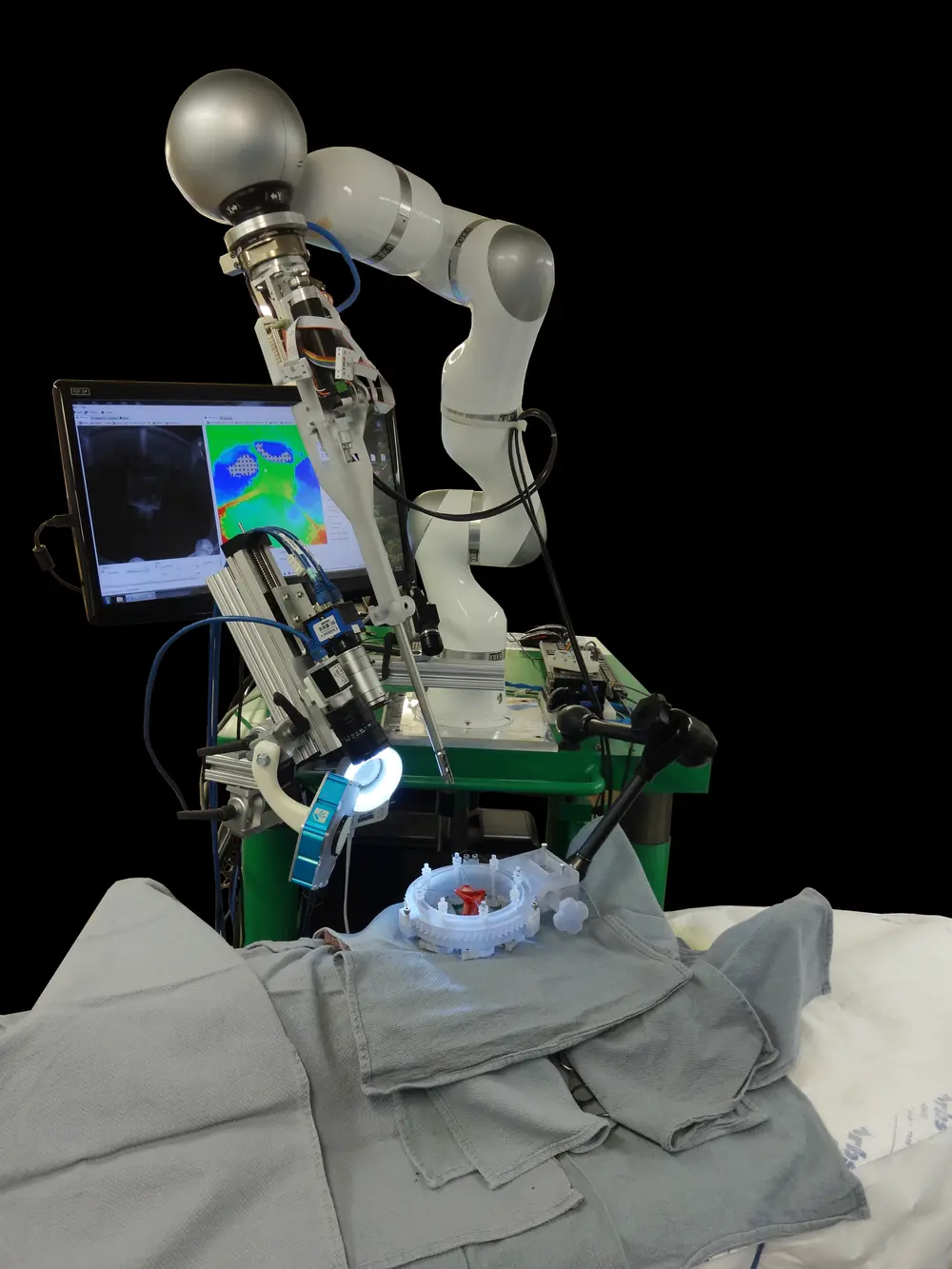 Система STAR 2016 года сшивает тонкий кишечник одной роботизированной рукой. На экране, расположенном за роботом, отображаются изображения в ближнем инфракрасном диапазоне и 3D-изображения одновременно.