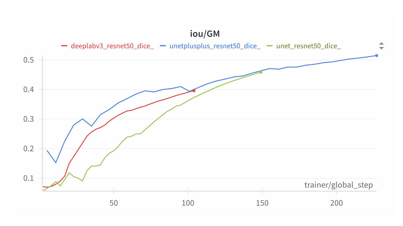 Метрики сегментации серого вещества в зависимости от архитектуры сети