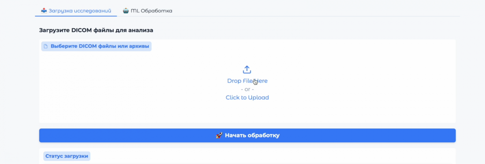 Повышаем точность диагностики ДЦП у новорожденных с помощью нейросетей - 15