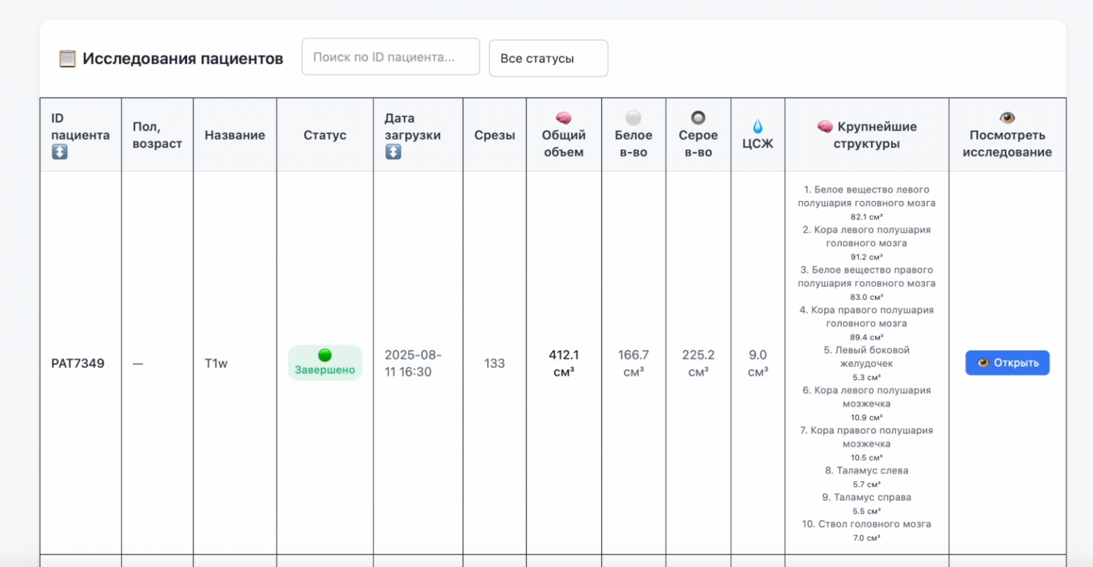 Повышаем точность диагностики ДЦП у новорожденных с помощью нейросетей - 16