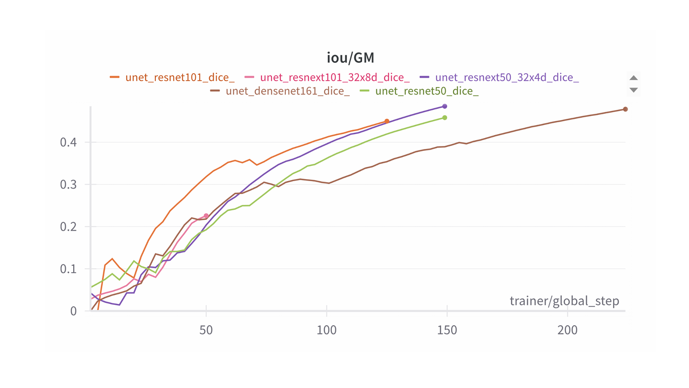 Метрики сегментации серого вещества в зависимости от backbone