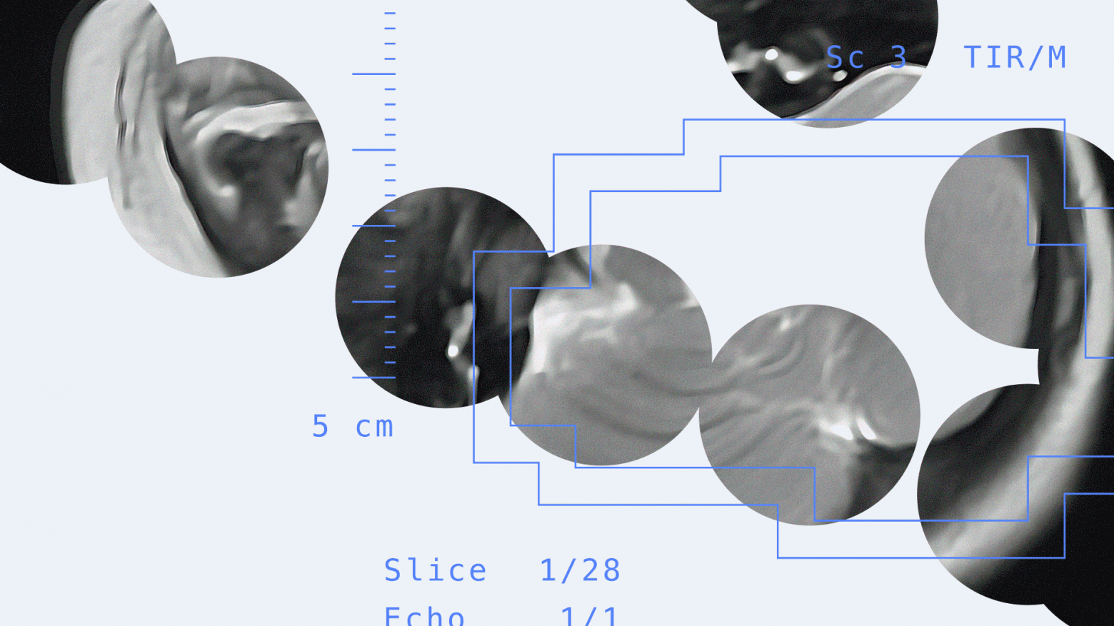 Повышаем точность диагностики ДЦП у новорожденных с помощью нейросетей - 1