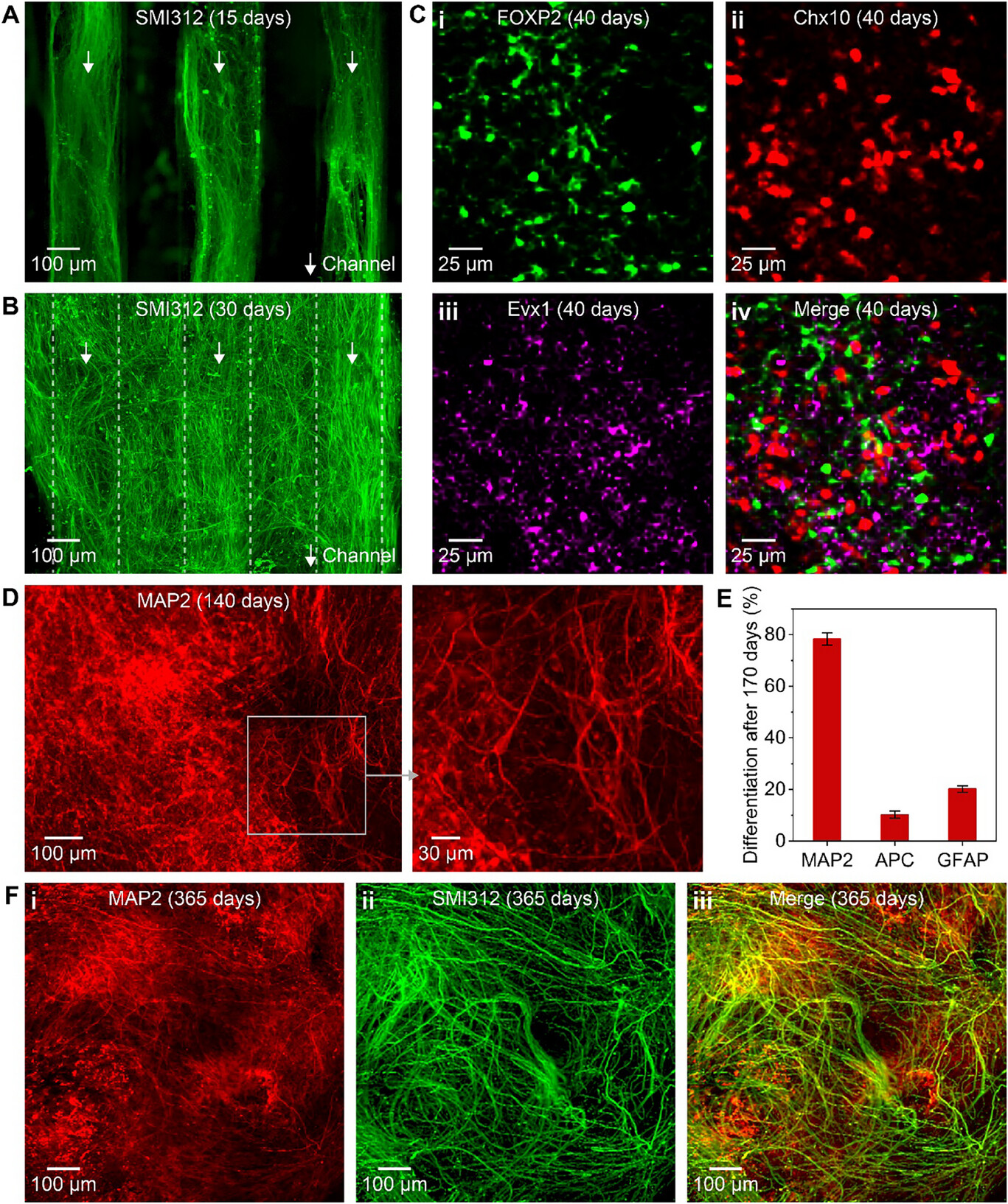 Спинной мозг на 3D-принтере - 3
